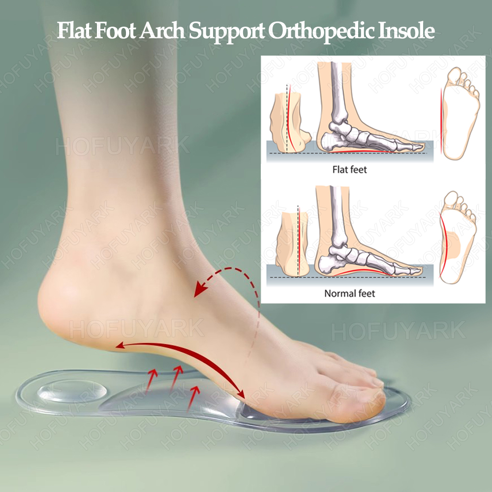 Silicone Gel Insoles Orthopedi - огляд і ціна Women'S Shoes With Plantar Fasciitis